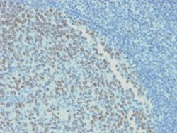 Bcl-6 Antibody (rBCL6/1718) - Azide and BSA Free, Novus Biologicals 100